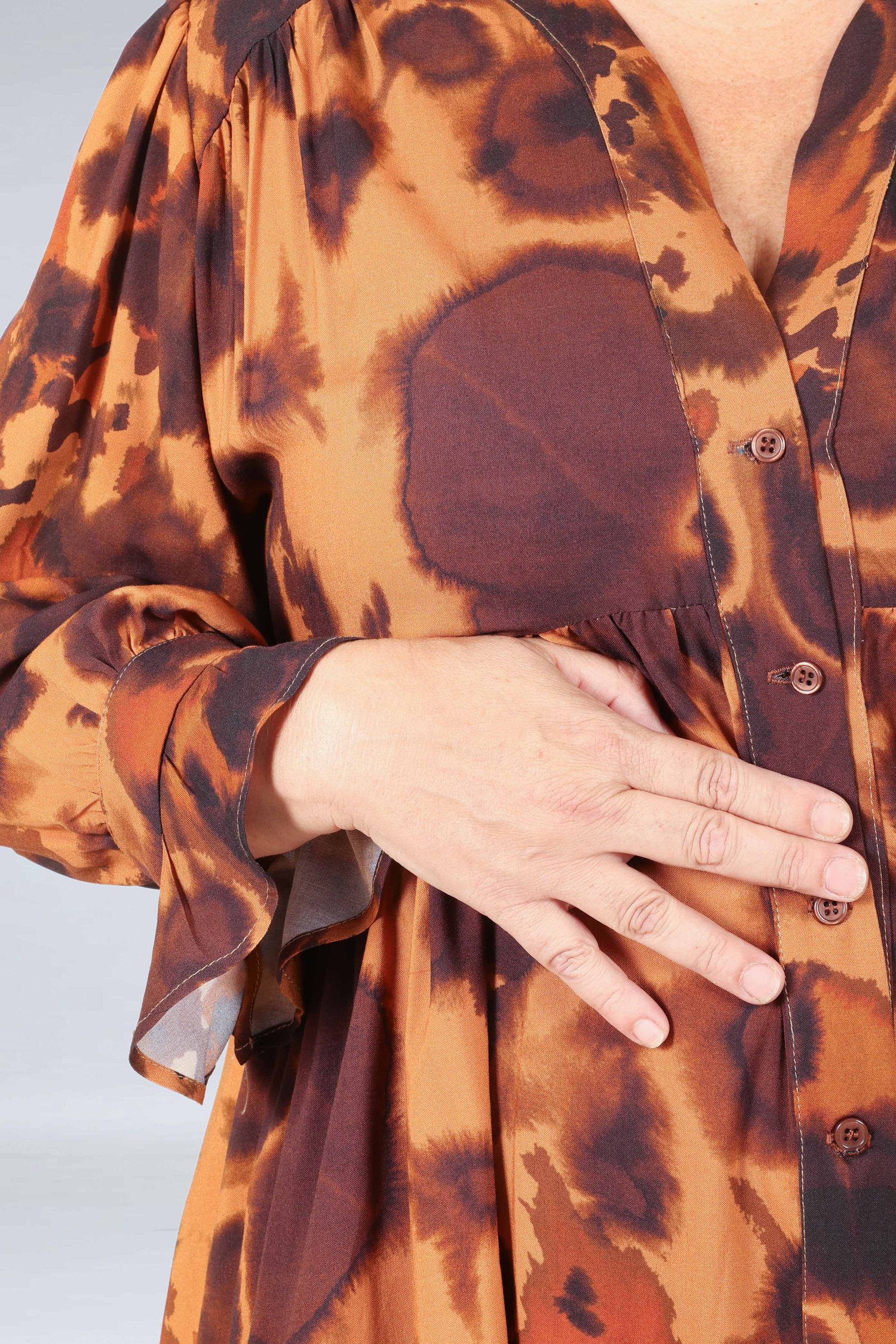 Printed button-up midi dress