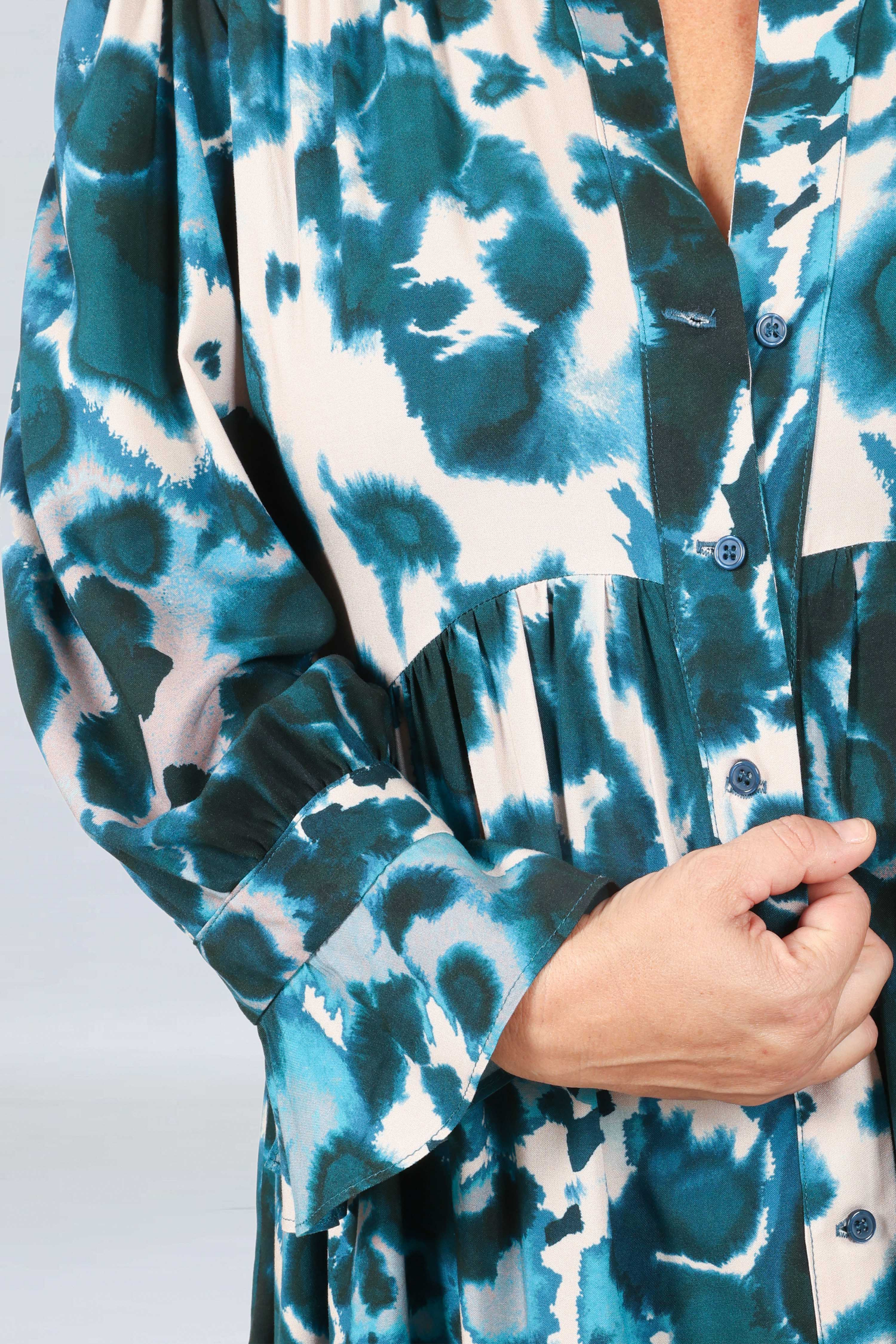 Printed button-up midi dress